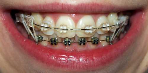 После того, как