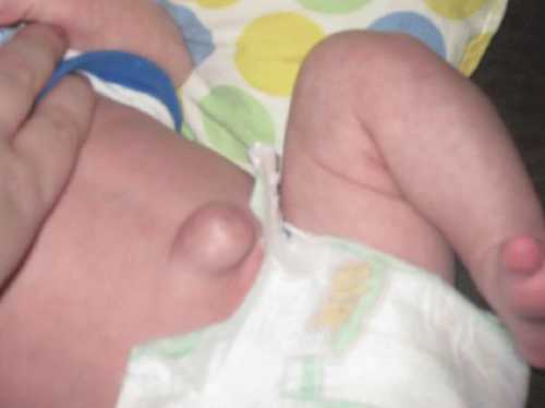 Рахит характеризуется недостатком в детском организме витамина в результате чего неправильно формируется скелет