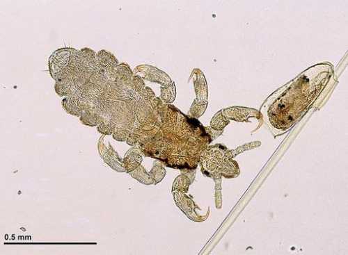 К чему снятся вши