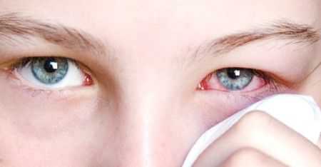 Конъюнктивит у детей: вирусный и бактериальный: