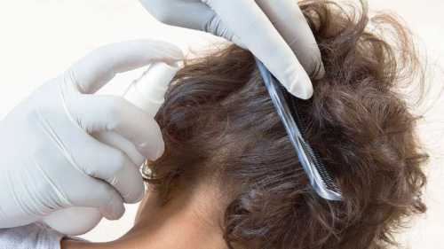 Придется также выполнять обработку при помощи