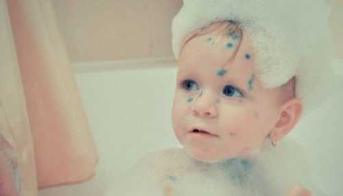 И чтобы не занести бактериальную инфекцию, необходимо подстраховаться частой дезинфекцией детских ладошек