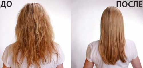 Шевелюра становится густой