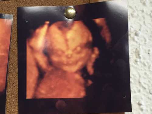 Фото мамы Урганта взбудоражило Сеть