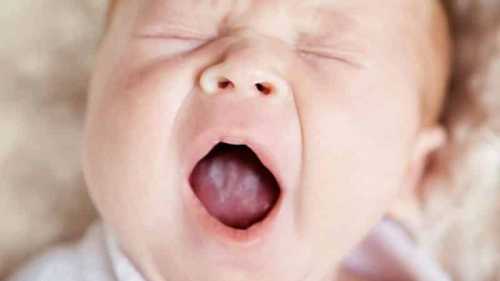 Белый налет на языке у ребенка