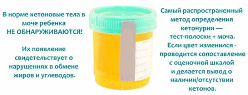 Если в полученных результатах отсутствуют изменения, характерные для патологий, способных вызвать симптомы кетоацидоза например, повышенный сахар, значит, можно диагностировать первичный ацедотиче ский синдром