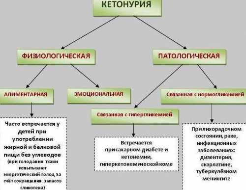 Ацетон в моче у ребенка кетоновые тела, кетоны