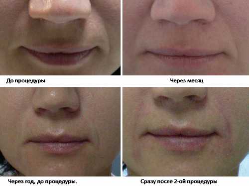 Вы можете прикрепить фотографию