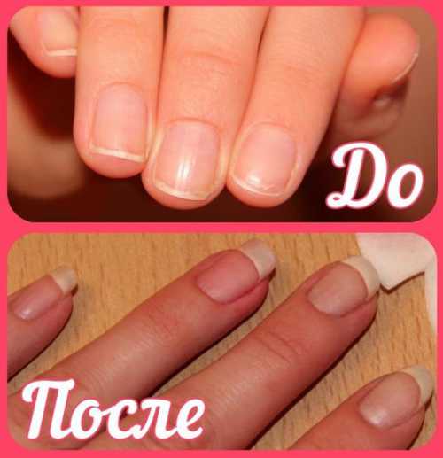 Этомасляные капсулы витаминов