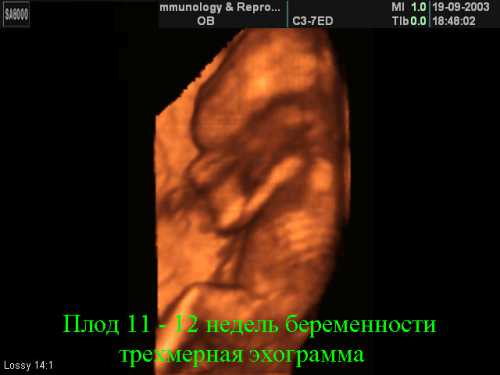 Размер плода на неделе беременности примерно составляет см