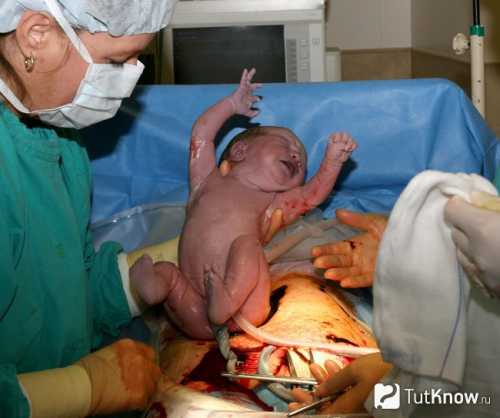 Повторяется профилактика через неделю дватри раза