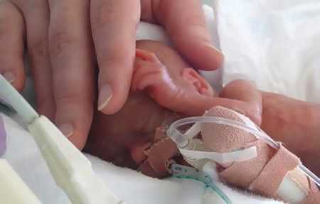 АПроводится электро релаксация препаратом