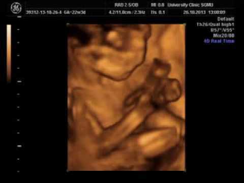 32 неделя беременности