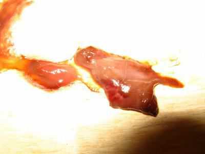 Продолжительность выделений может составлять дня