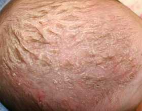 Выбранный шампунь следует нанести на влажные волосы и хорошенько вспенить