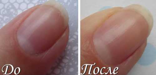 Процедура месяца: витаминный заряд