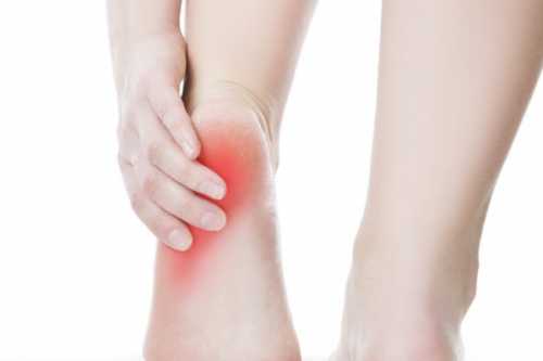 Болит пятка при ходьбе