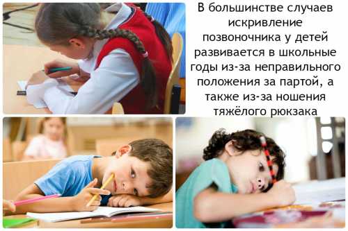 Нарушения осанки у детей
