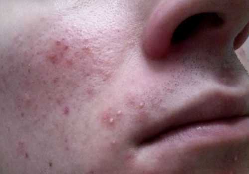 Всего их потребуется двадцать