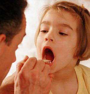 При фолликулярном тонзиллите у детей в паренхиме миндалин организуются мелкие подэпителиально расположенные гнойники, напоминающие просяные зерна