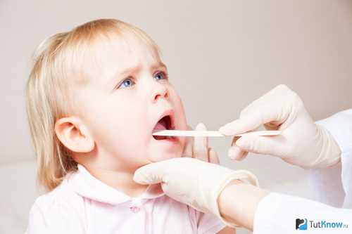 Тонзиллит у ребенка и кондиционер