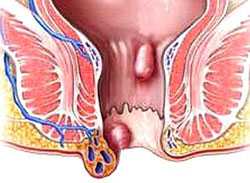Затем они размягчаются до пюре