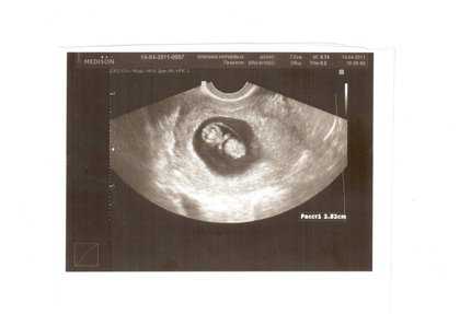 Первая неделя беременности